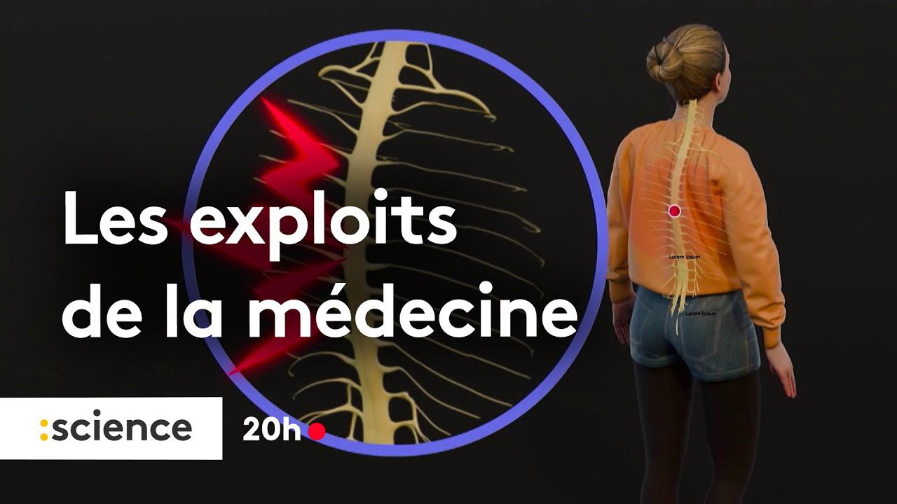 Les exploits de la médecine