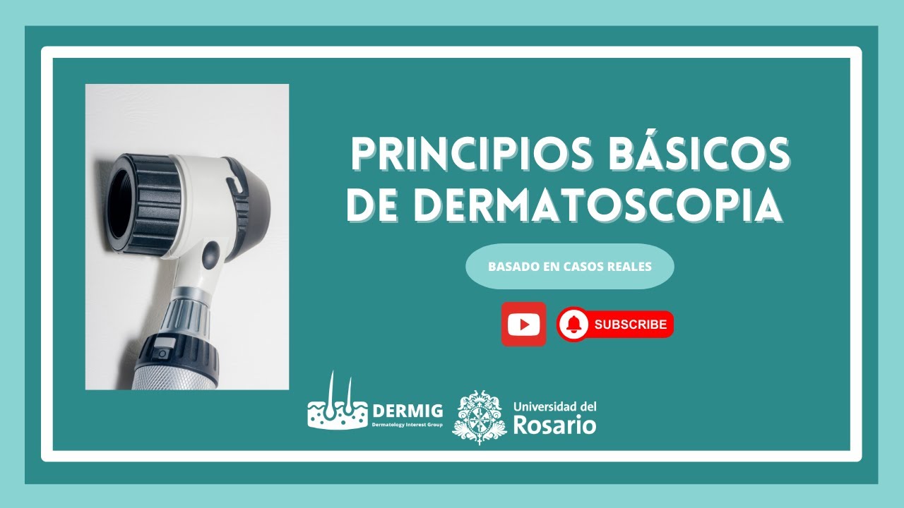 Uso del dermatoscopio en el consultorio