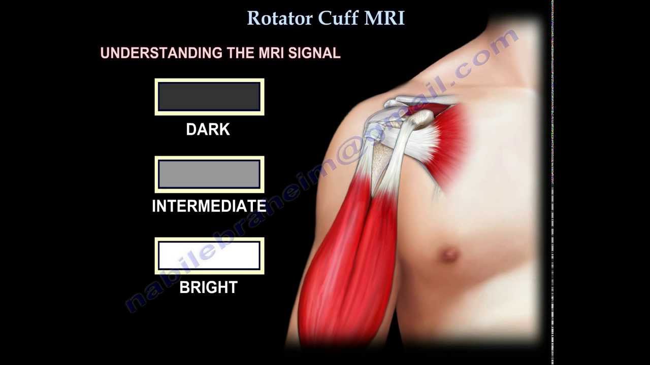 Rotator Cuff MRI - Everything You Need To Know - Dr. Nabil Ebraheim