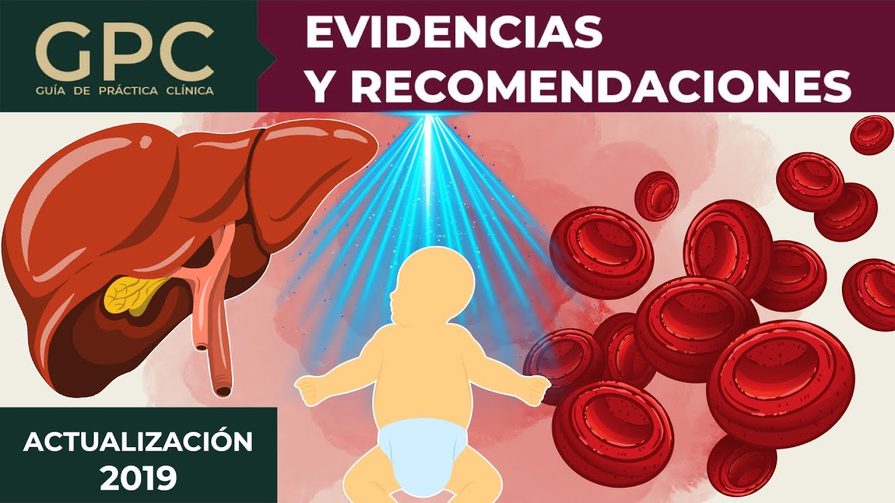 GPC Diagnóstico y Tratamiento de Ictericia Neonatal