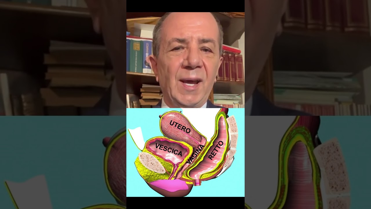 PROLASSO DI UTERO E VESCICA: POPS: L'INTERVENTO SALVA UTERO