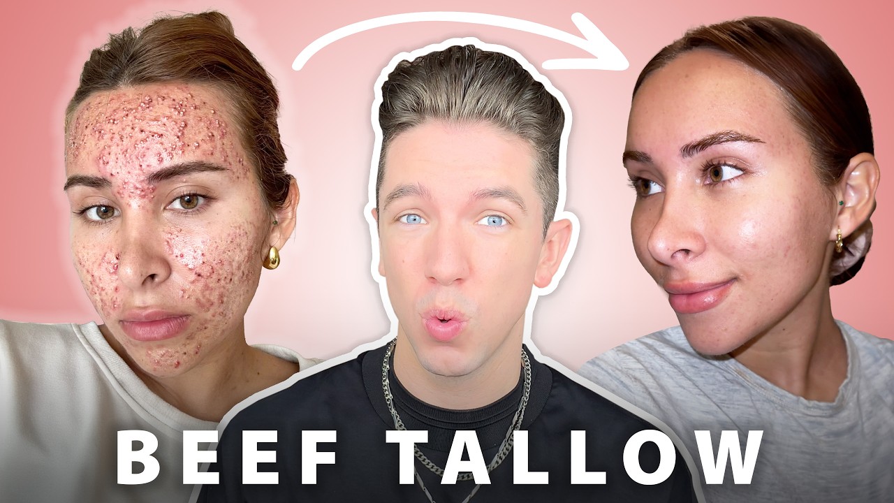 Beef Tallow For Your Skin… Is It Worth The Risks?