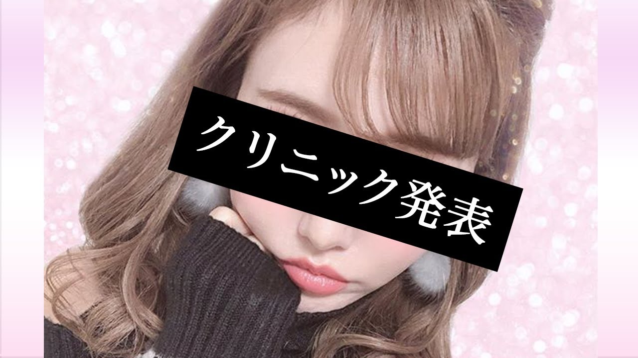 【 眼瞼下垂 】 二重幅 全切開 修正 の ダウンタイム の 様子をお見せします。& クリニック 発表 【 整形 】
