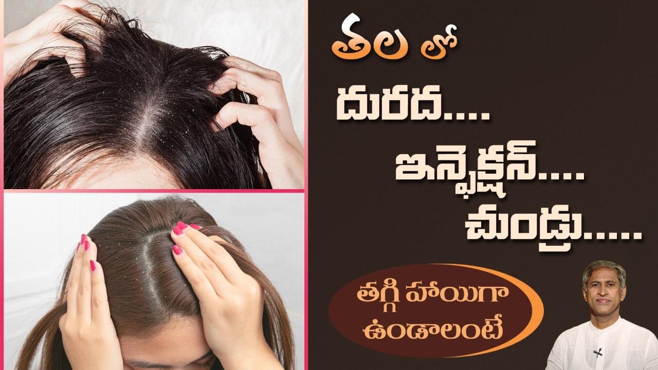Hair Mask for Healthy Hair Follicles | Get Rid of Dandruff and Itching| Dr. Manthena's Beauty Tips