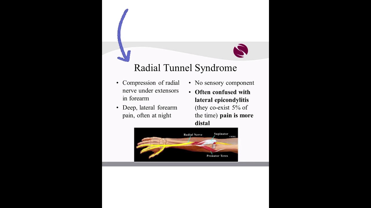 Radial Tunnel Surgery
