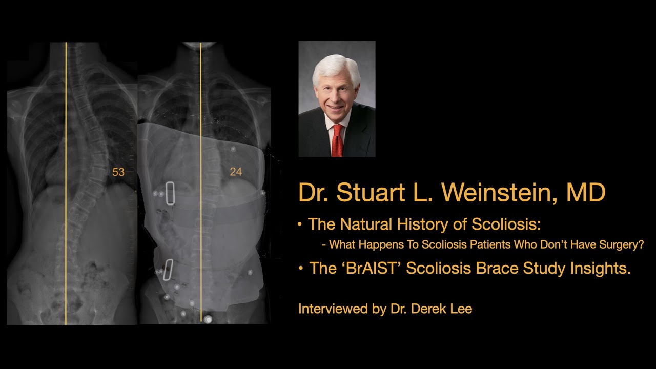 Dr. Stuart Weinstein, MD, The Natural History of Scoliosis and the BrAIST study, by Dr. Derek Lee