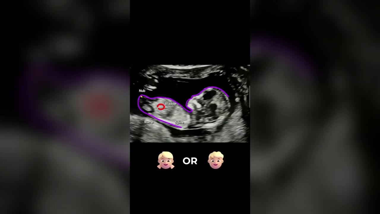 AI Gender Reveal app in the world, NubX #pregnancy  #babygender #genderexpression #pregnant