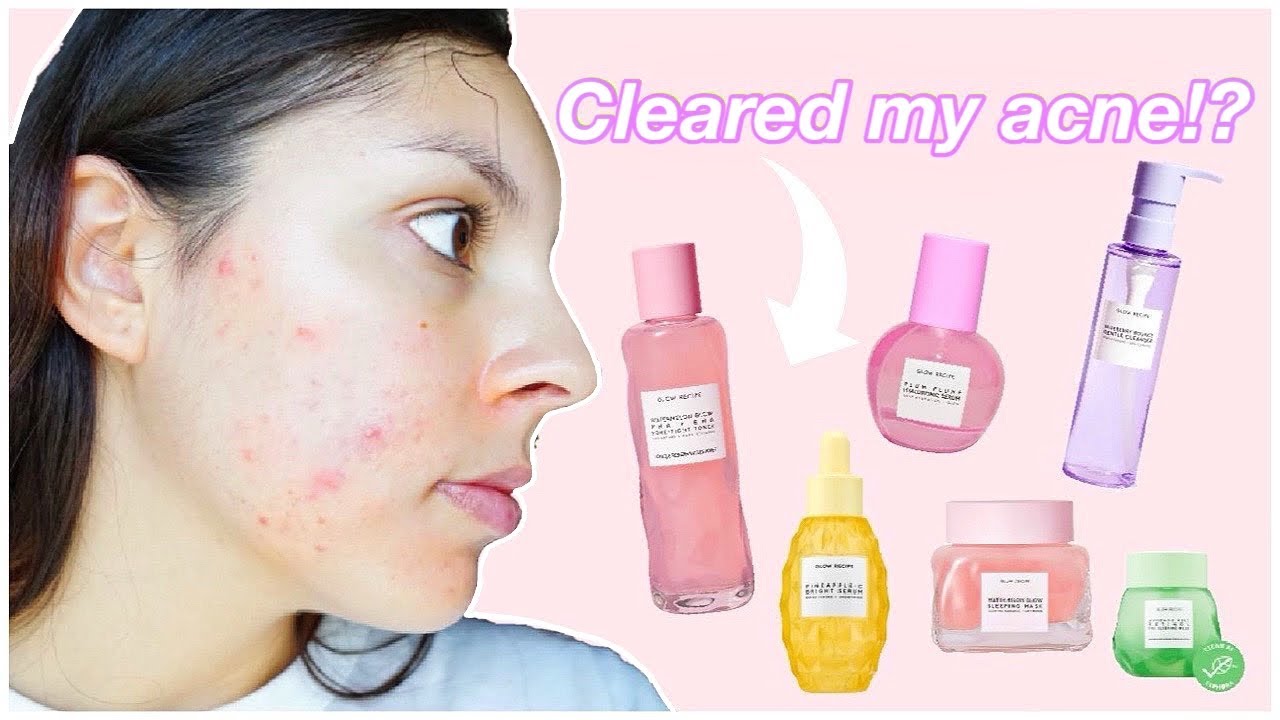Glow Recipe Review on ACNE PRONE SKIN