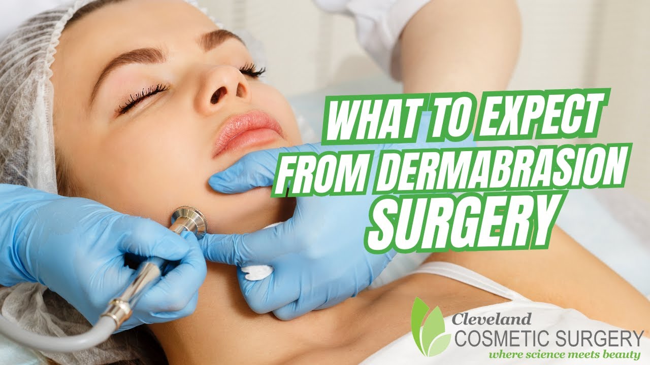 What to Expect from Dermabrasion Surgery