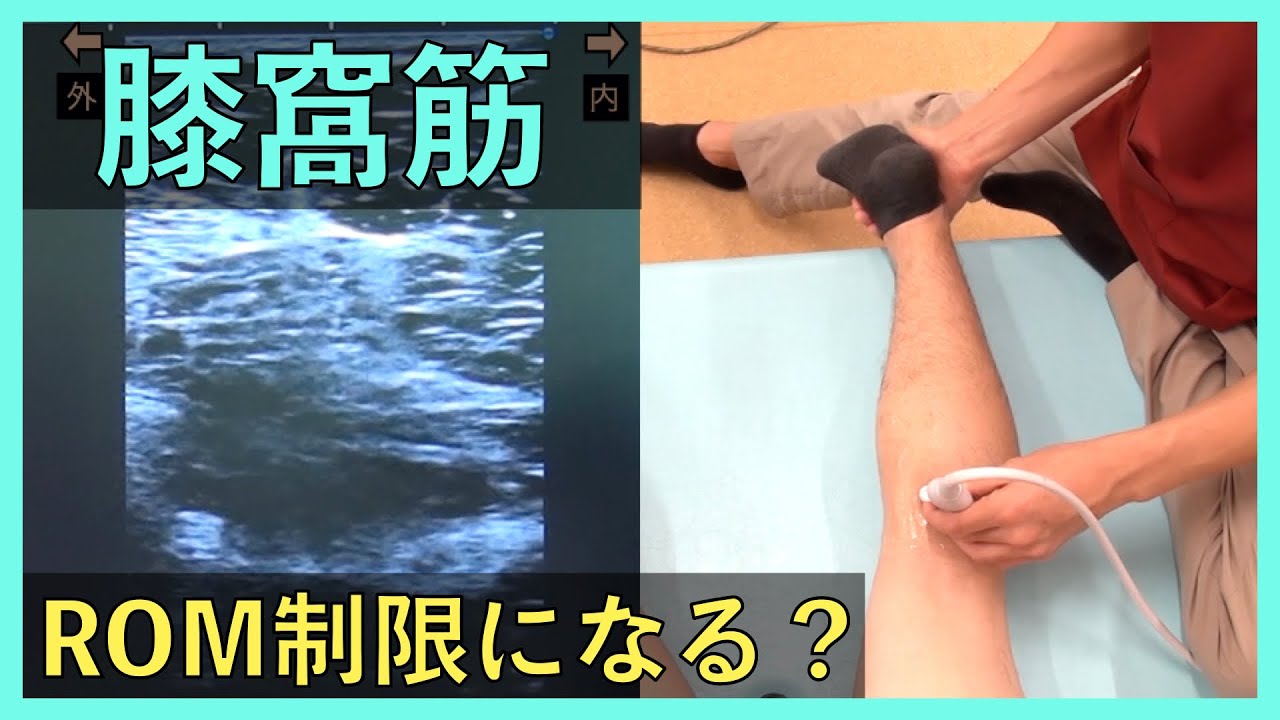 【膝窩筋】伸展ROM制限因子？