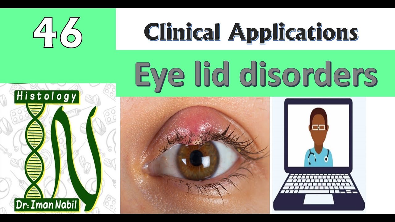 46-Eye lid disorders إضطرابات جفن العين-Clinical applications of Histology-Eye