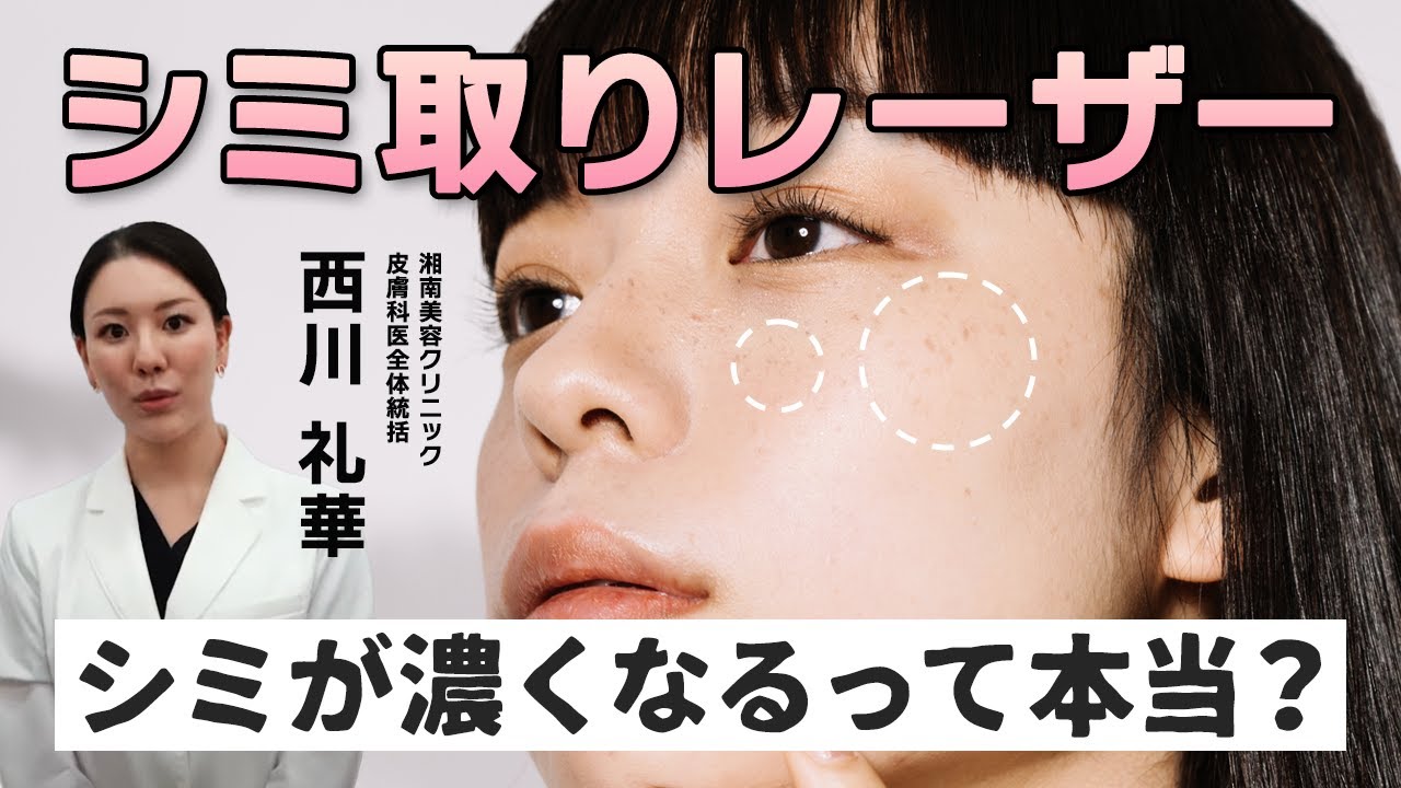 【医師が解説】シミ取りレーザーをしたらシミが濃くなるって本当？メリット・デメリットを解説します。【湘南美容クリニック】