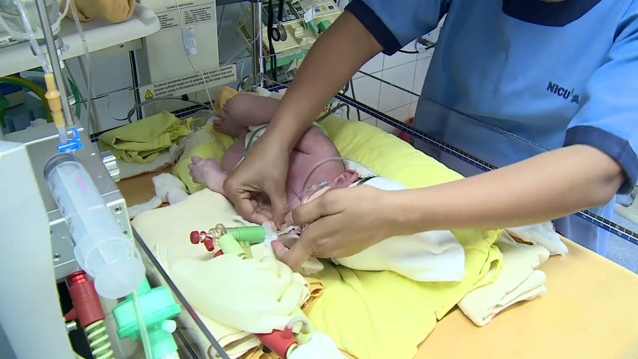 Care of infants on high  frequency ventilation
