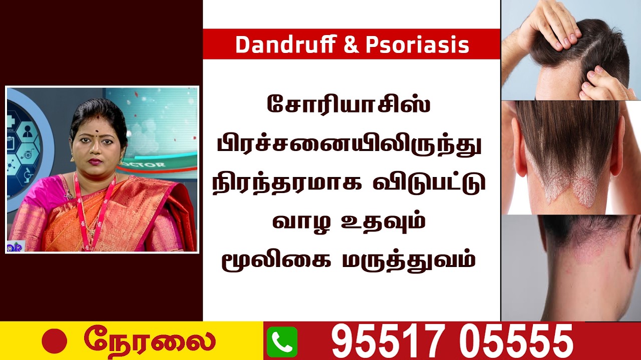 🛑LIVE | சொரியாசிஸ் ஏற்பட காரணம் என்ன ? அதை முழுமையாக சரிசெய்யும் மூலிகை சிகிச்சை | RJR | Psoriasis