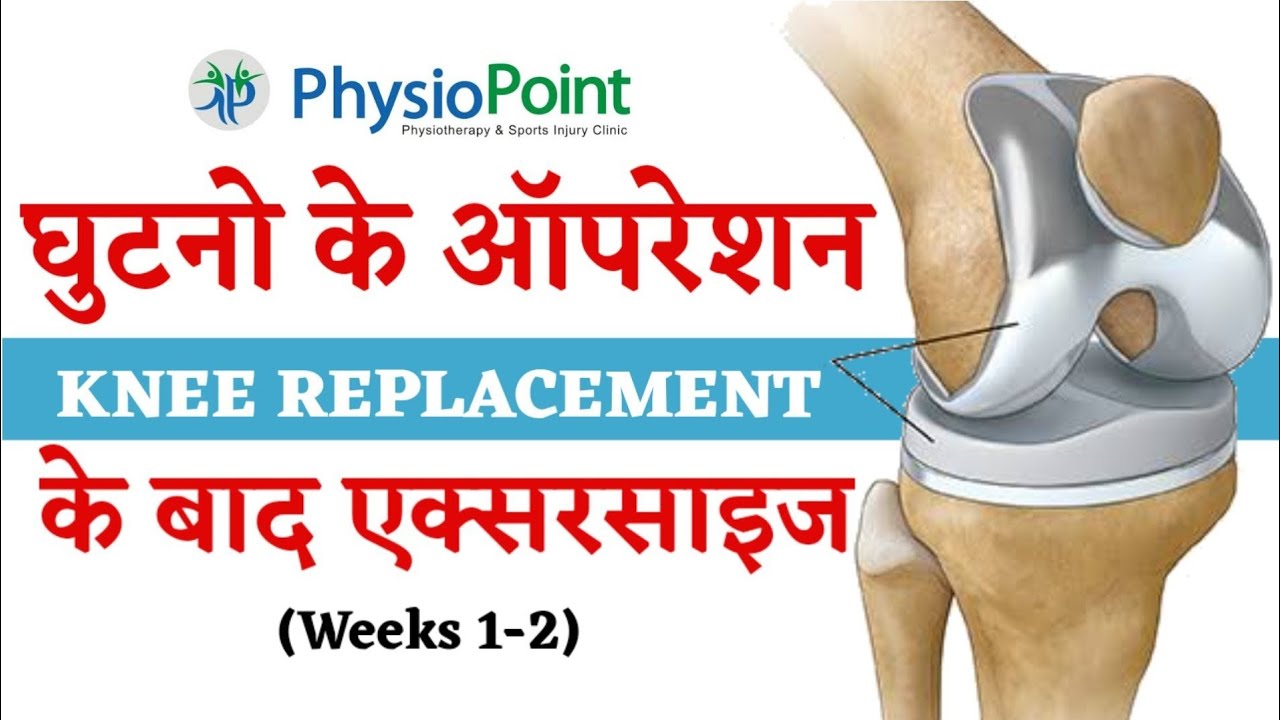 घुटने के आपरेशन के बाद की एक्सरसाइज - Best exercise for post operative knee surgery ( weeks 1-2 )