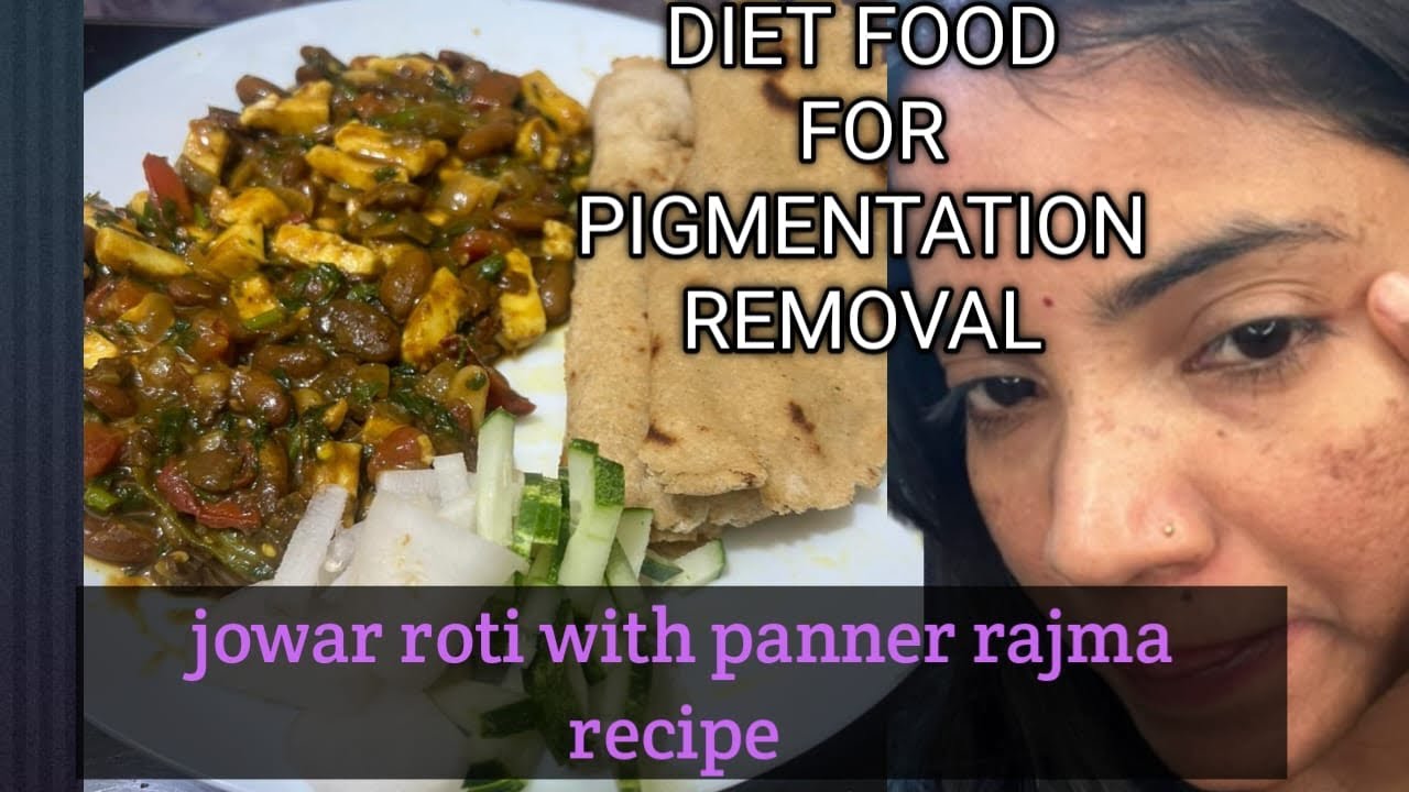 Diet food for weight loss |remove pigmentation | 