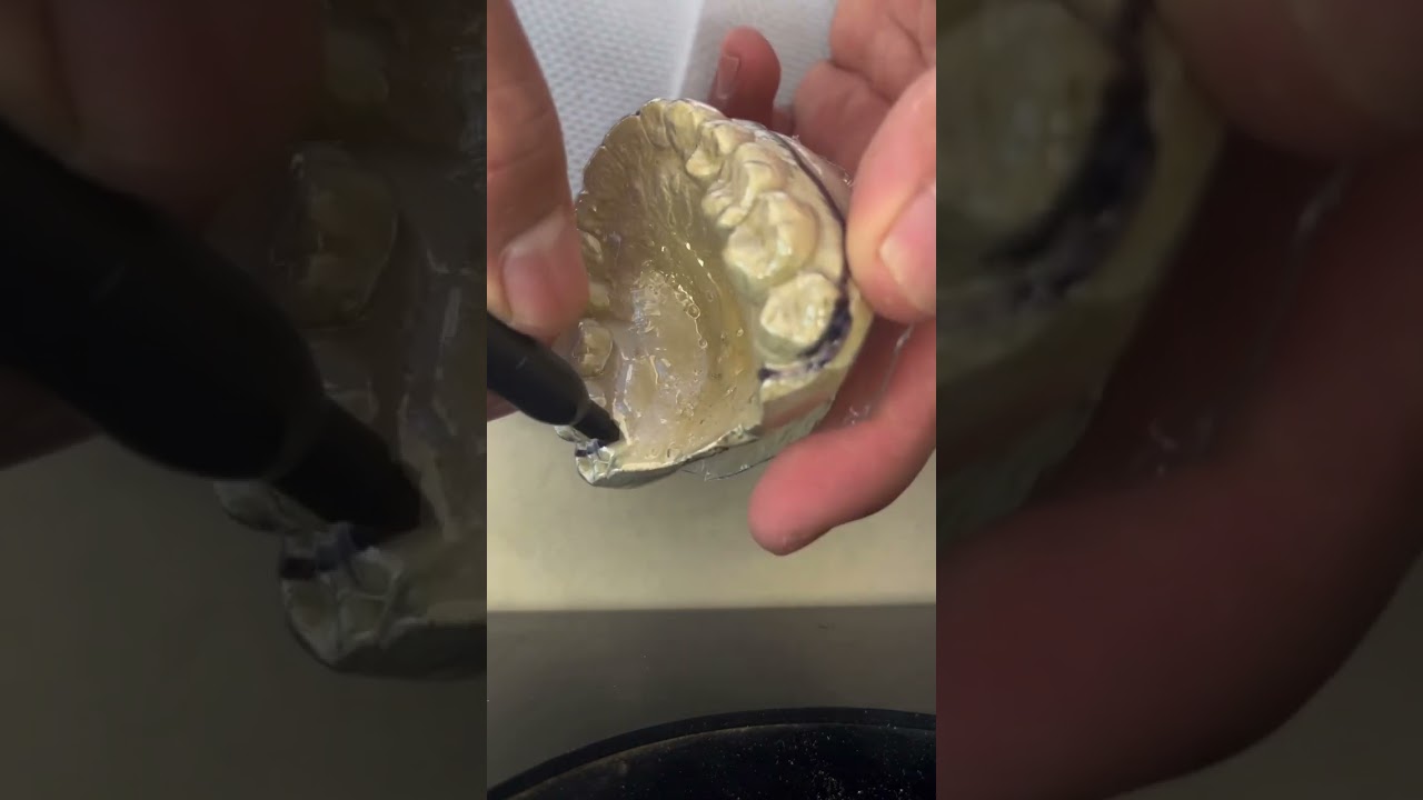 Cómo hacer un guarda funcional o Retenedor Odontologia