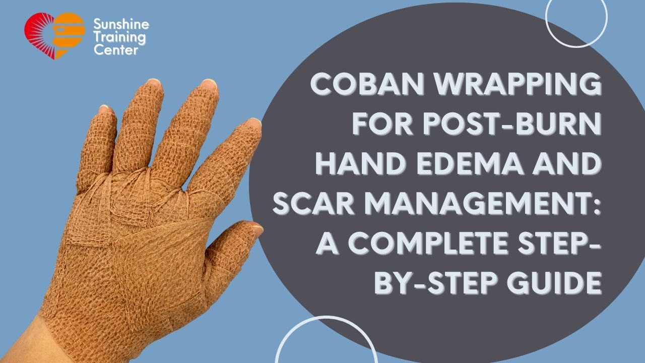 Coban Wrapping for Post-Burn Hand Edema and Scar Management: A Complete Step-by-Step Guide