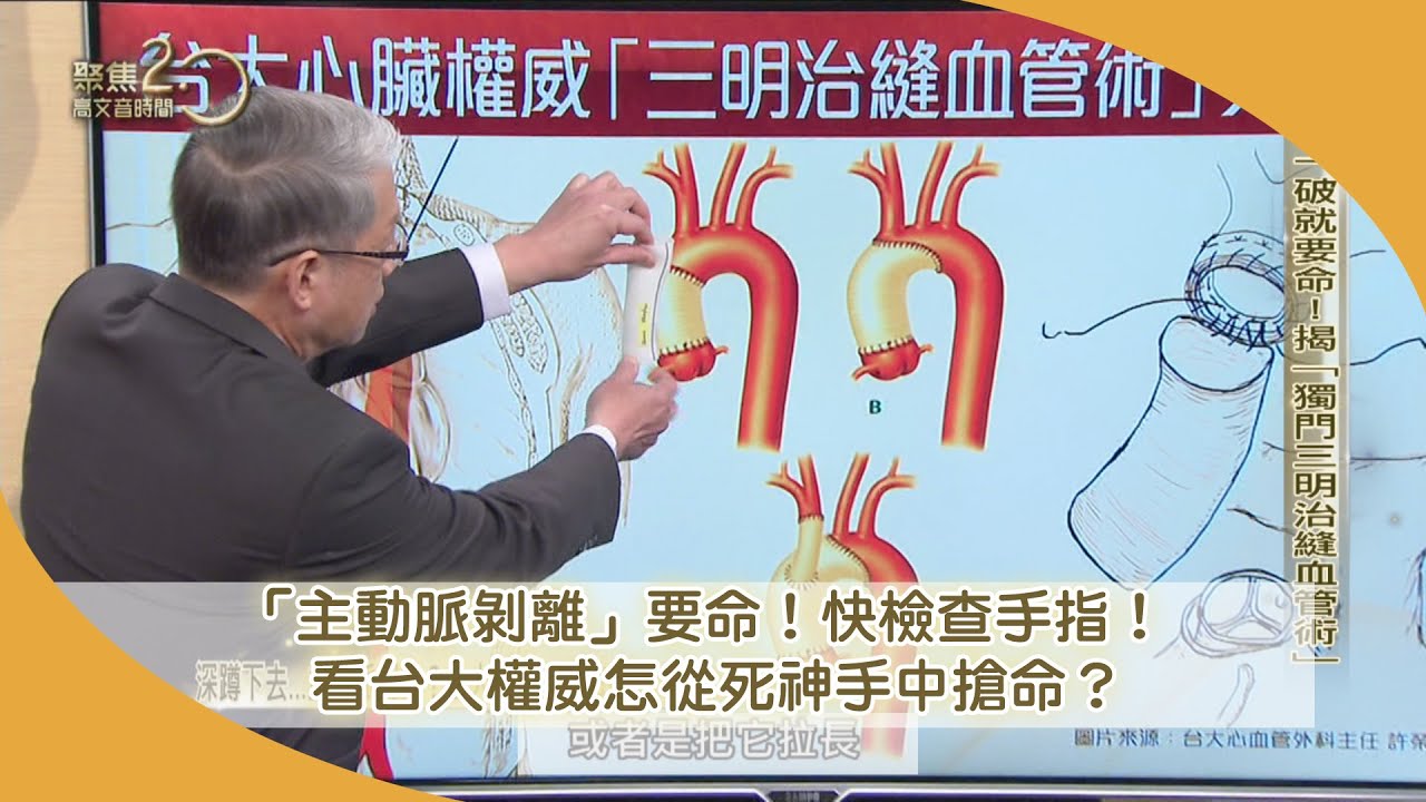 台大心臟權威來了！救「主動脈剝離」NO.1！一秒測手指！「長這樣」是高危險群！【聚焦2.0】第474集