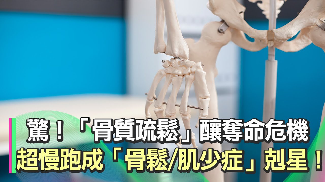 「骨質疏鬆」成奪命危機！20歲女「常曬太陽＋愛爬山」仍骨鬆！ 醫：「做錯1事」補充維生D＝做白工！｜不是「膝蓋痛」骨質疏鬆3前兆曝光！醫：可靠「超慢跑」預防骨鬆、防肌少症｜祝你健康