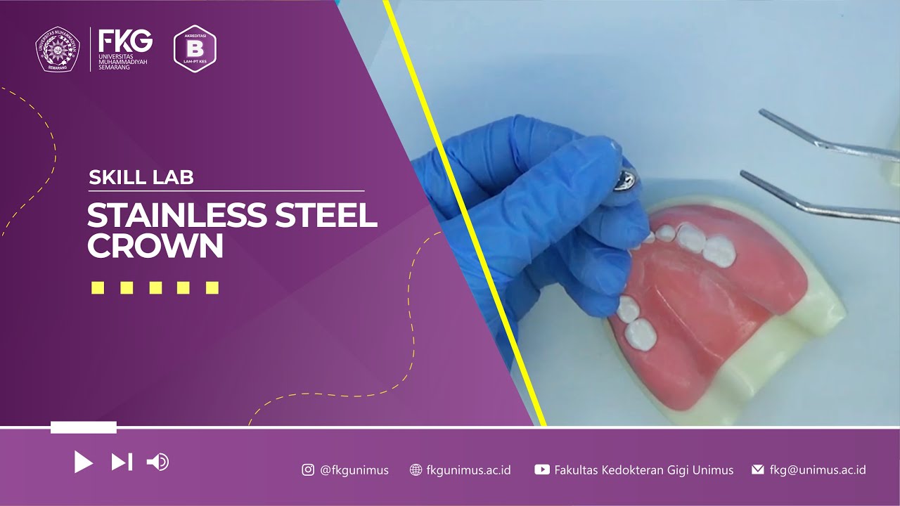 Skill Lab - Stainless Steel Crown