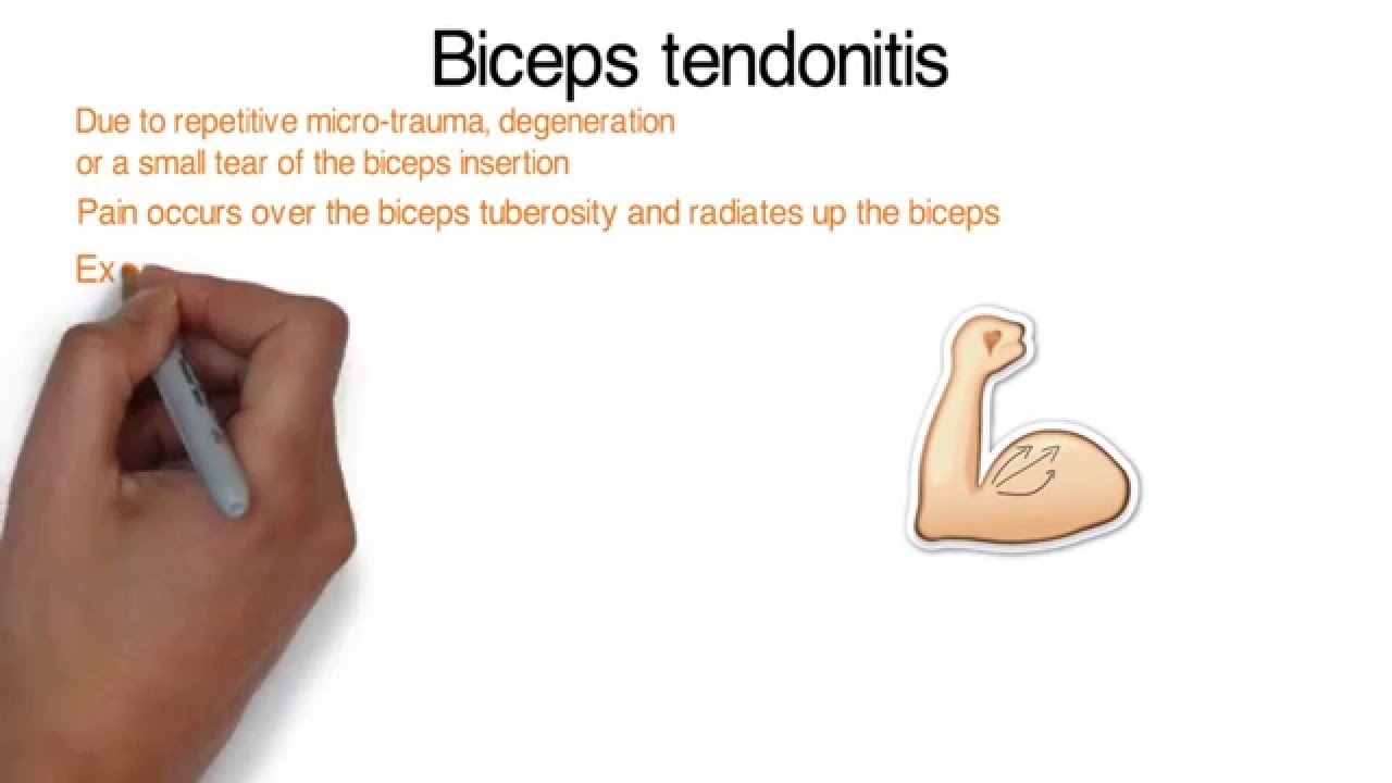 Elbow anatomy and examination - orthopaedic teaching video Cape Town