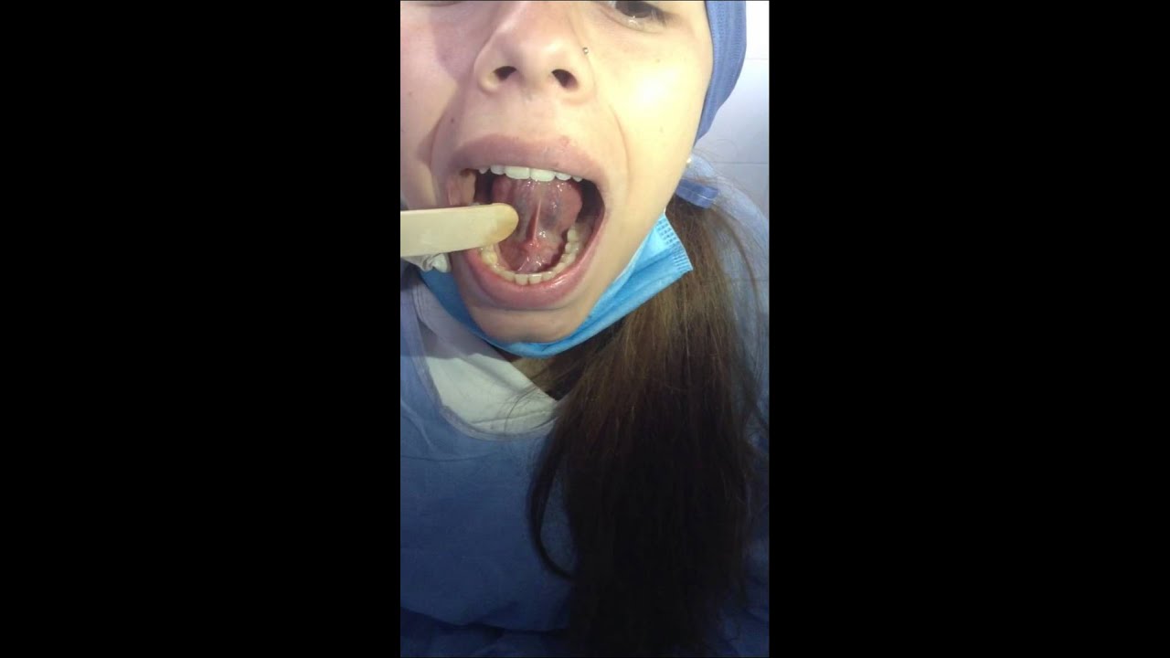 Cavidad Oral