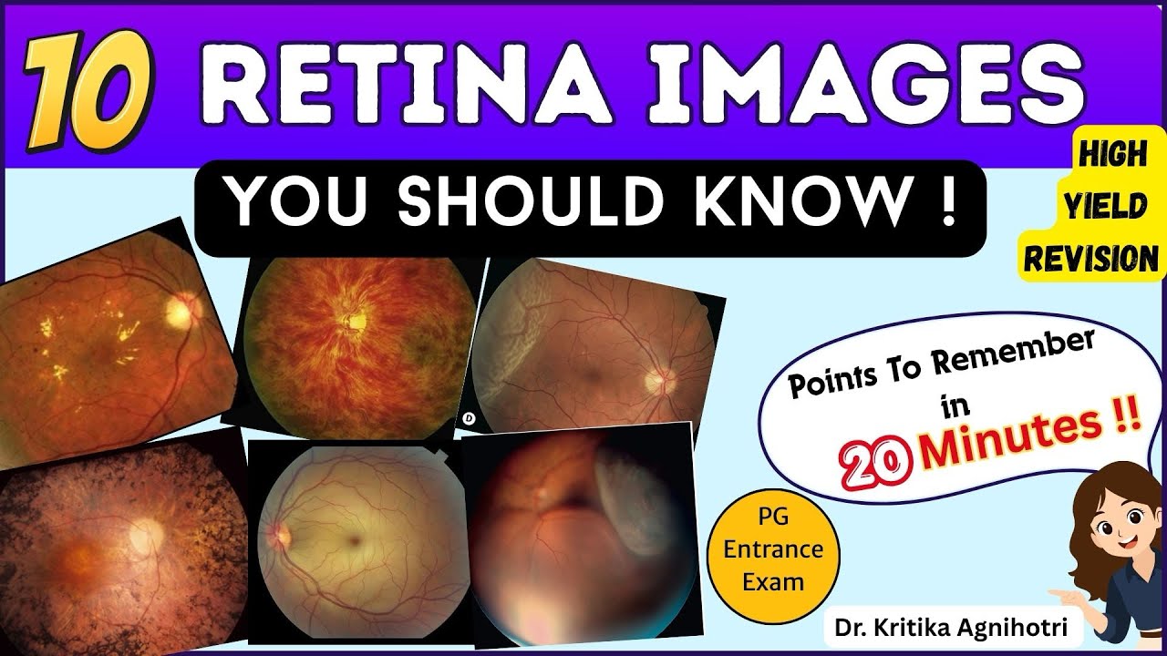 10 Retina Images You Should Know | High Yield Revision | PG Entrance Exam