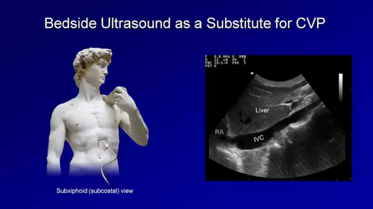 Shock: Lesson 2 - Distinguishing Shock Types (Hypovolemic/Distributive/Cardiogenic/Obstructive)