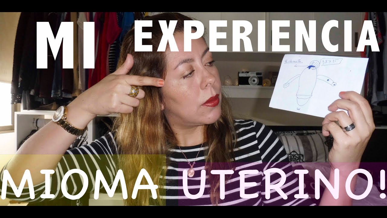 MIOMA UTERINO MI EXPERIENCIA | ALBIÑAFE COELLO