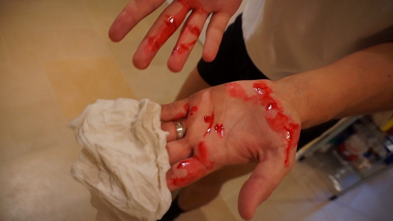 my aggressive dog bit me..