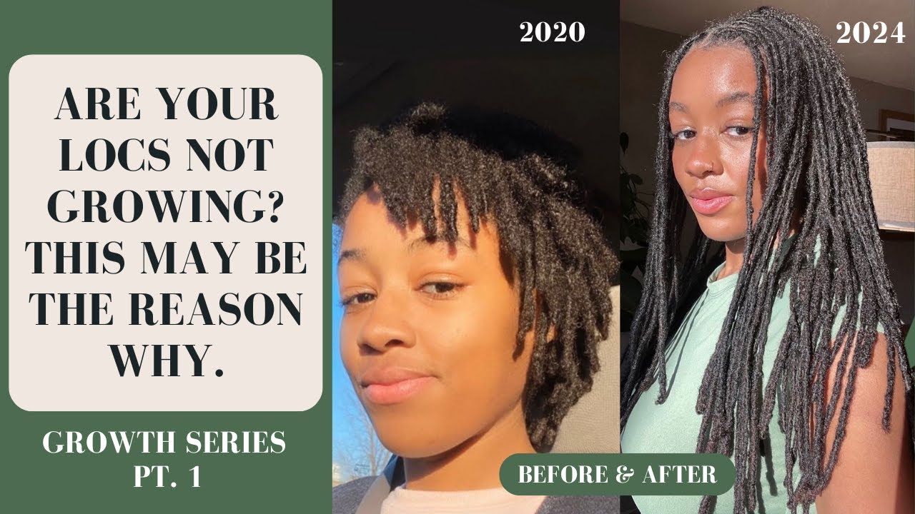 Are Your Locs Not Growing? This May Be The Reason Why | Growth Series Pt.1 | Loc Growth Tips