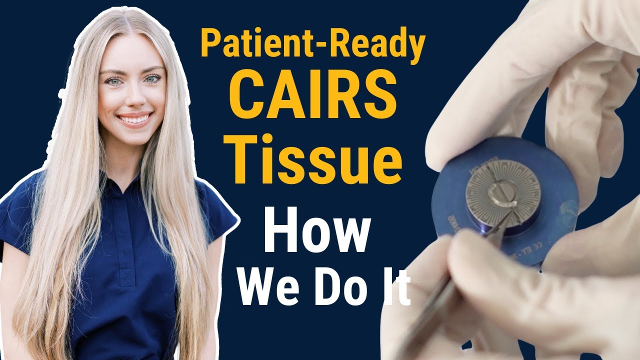 Patient-Ready CAIRS Tissue: How We Do It
