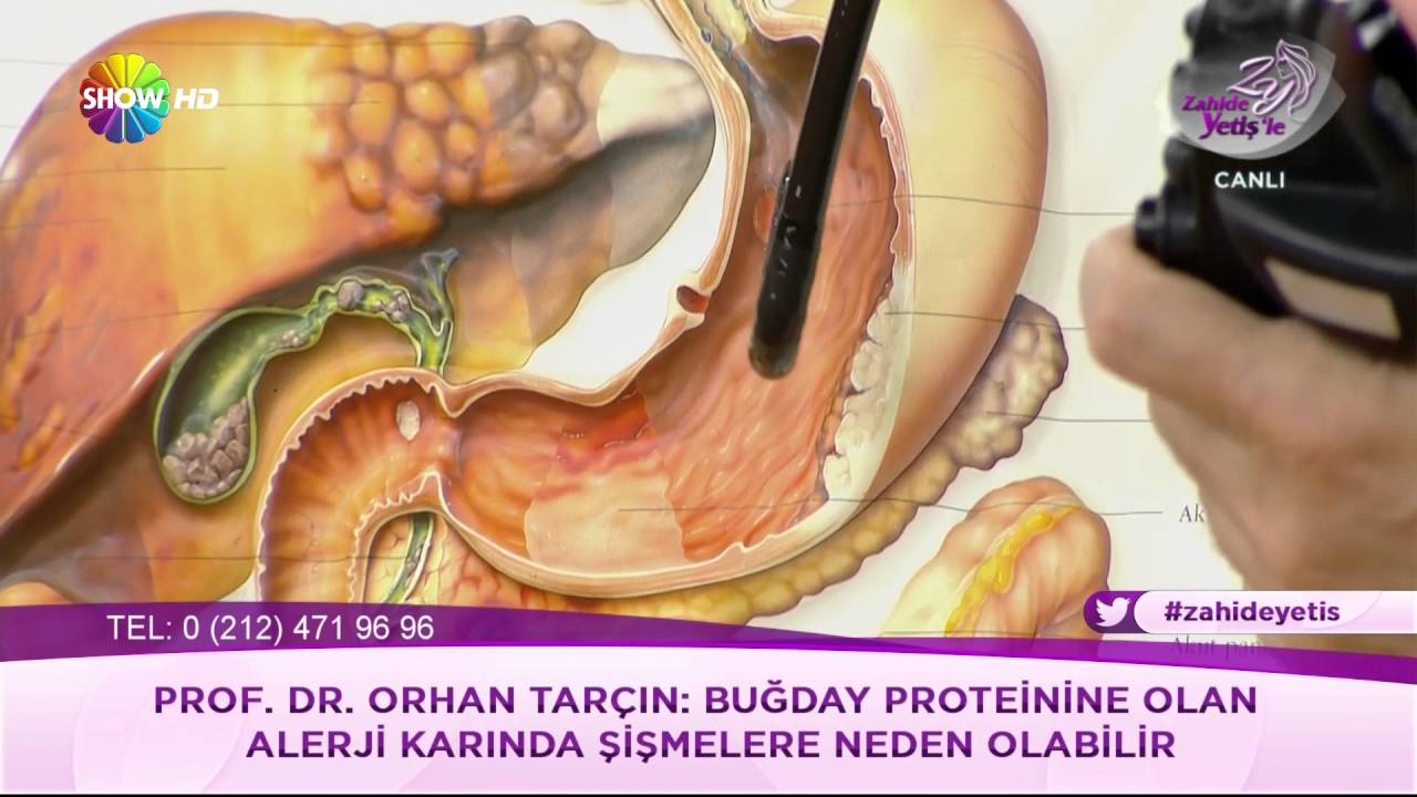 Endoskopi korkusunu yenin!