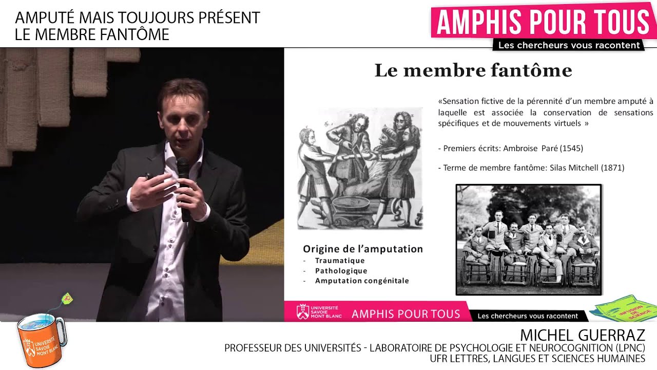 Amphis Pour Tous : Amputé mais toujours présent, le membre fantôme
