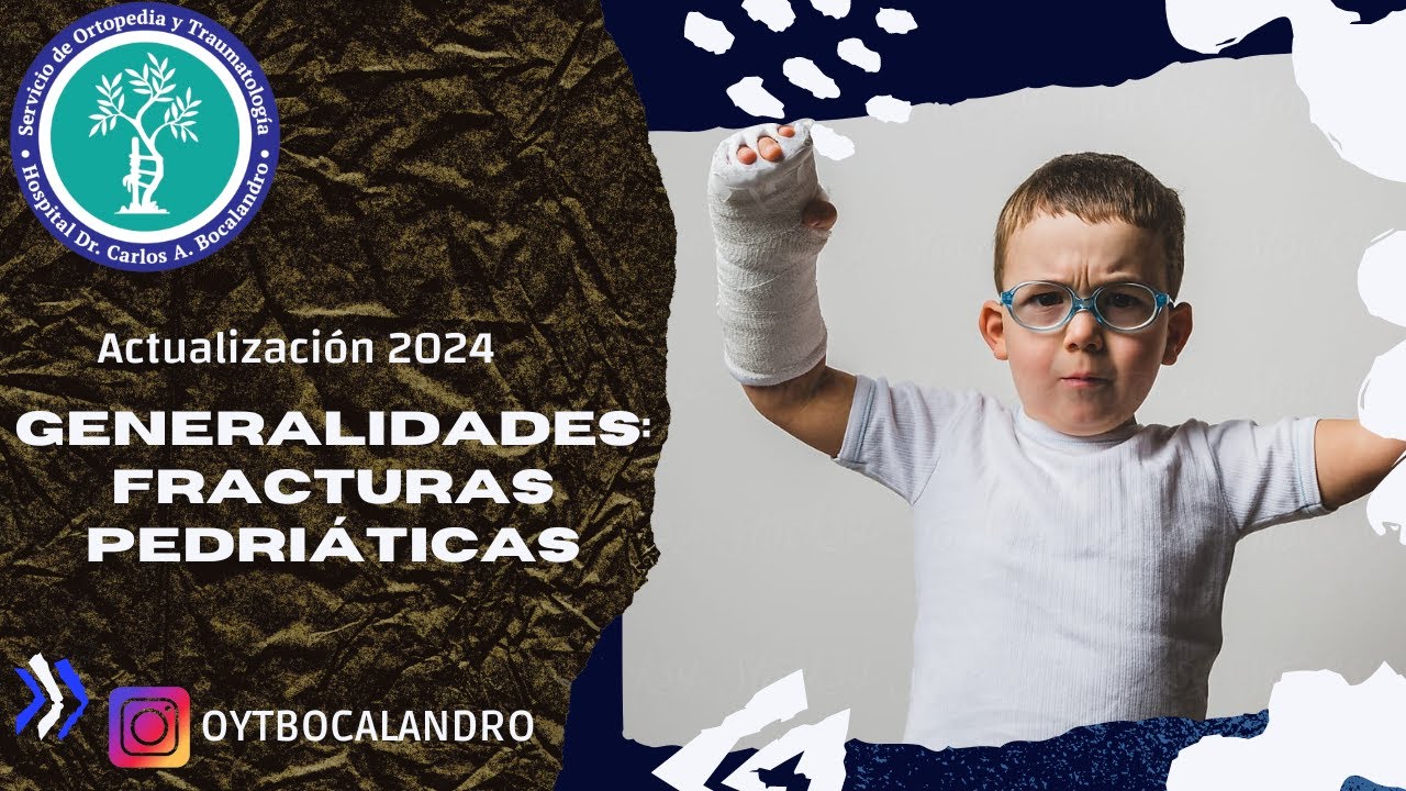 Generalidades de Fracturas Pediatricas