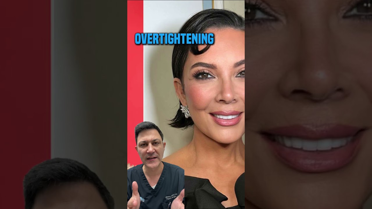 Kris Jenner&rsquo;s Cosmetic Surgery Breakdown 🤯 #shorts