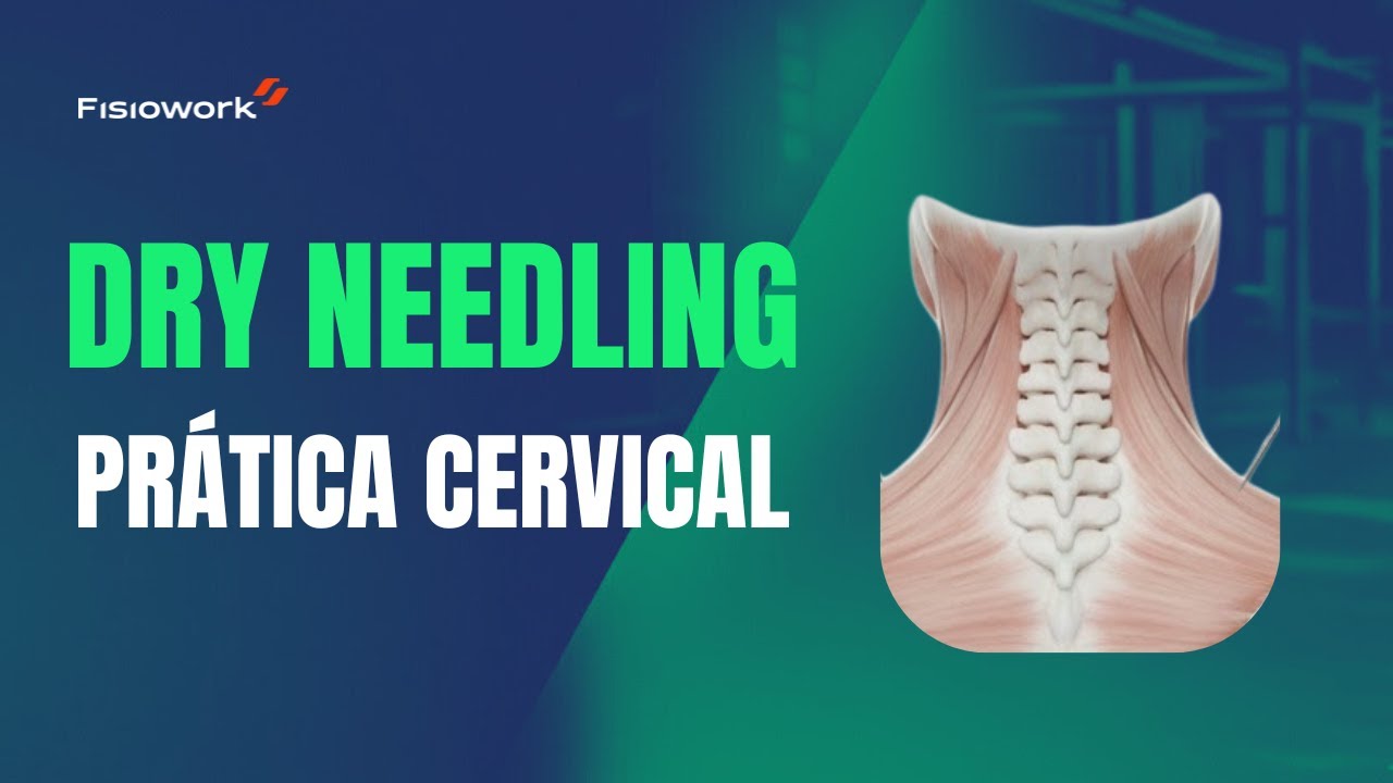 ACABE COM A DOR CERVICAL - DRY NEEDLING