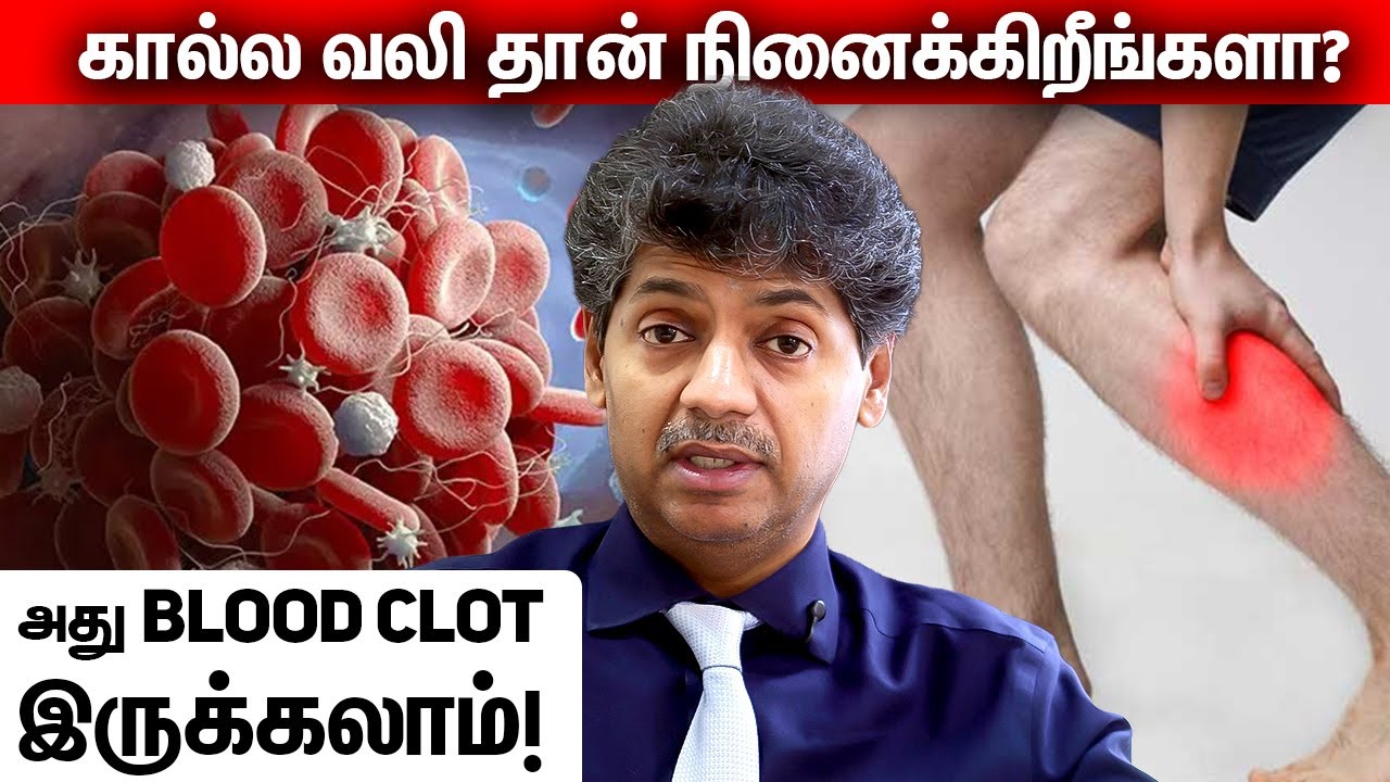 கால்ல வலி தான் நினைக்கிறீங்களா? அது Blood Clot இருக்கலாம்! | DR Bala Kumar