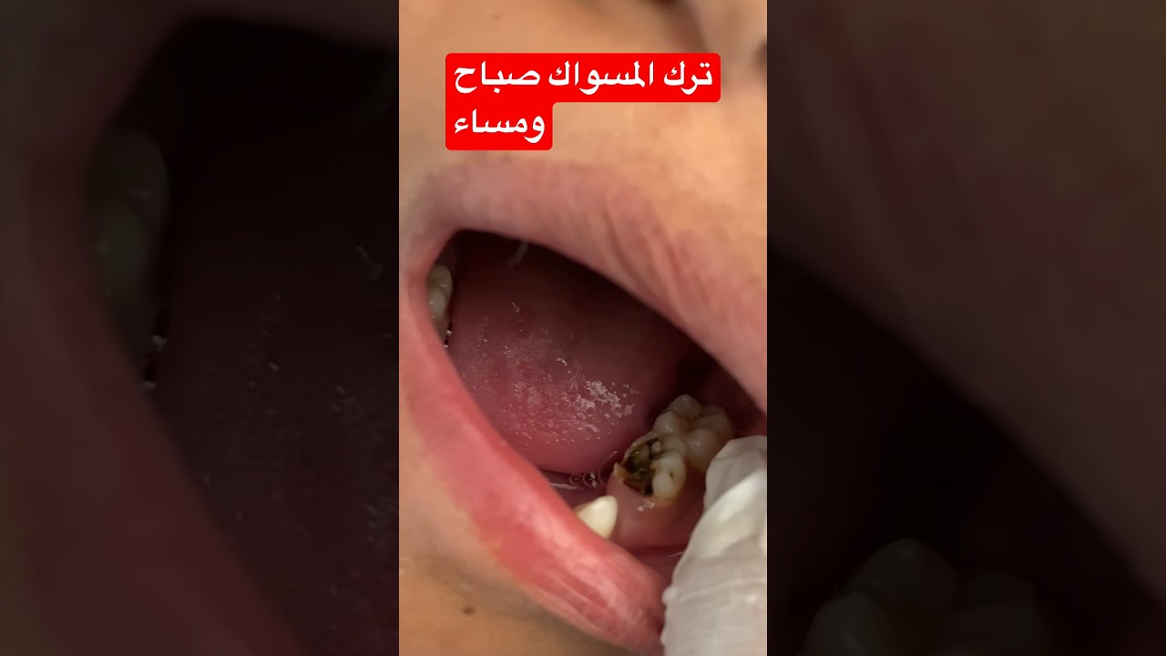 ترك المسواك صباح ومساء