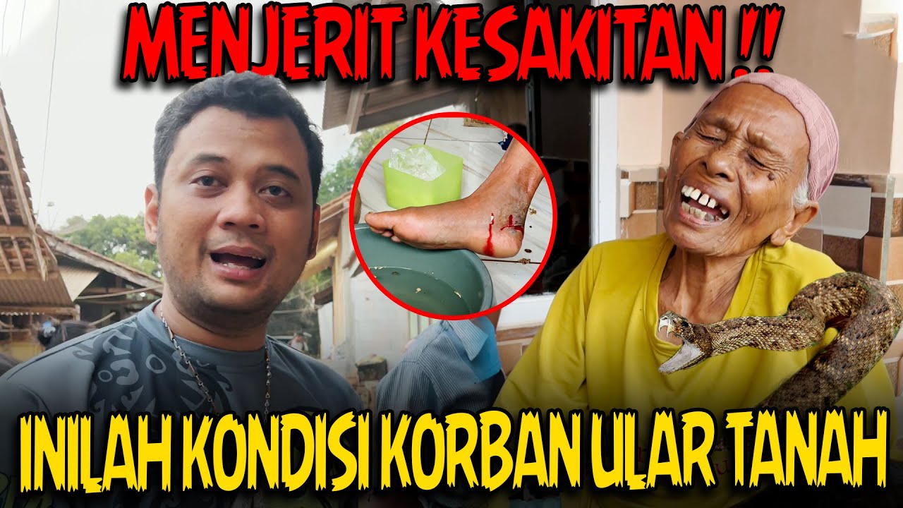 BEGINI KONDISI TERBARU EMAK KORBAN GIGITAN ULAR TANAH !!