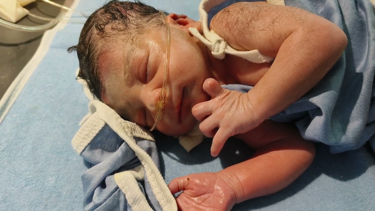 Premature baby|| KMC Baby weight 2kg||