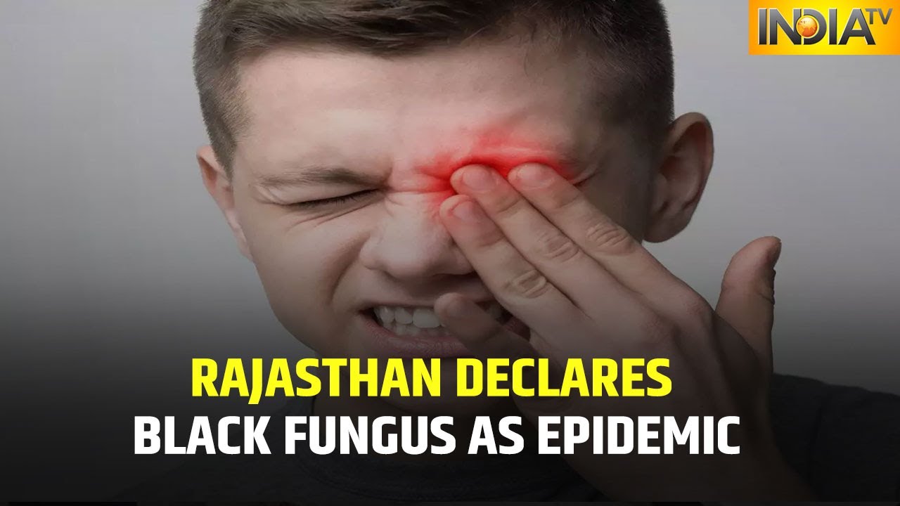 Rajasthan Declares Black Fungus As Epidemic, Cases Rise In State