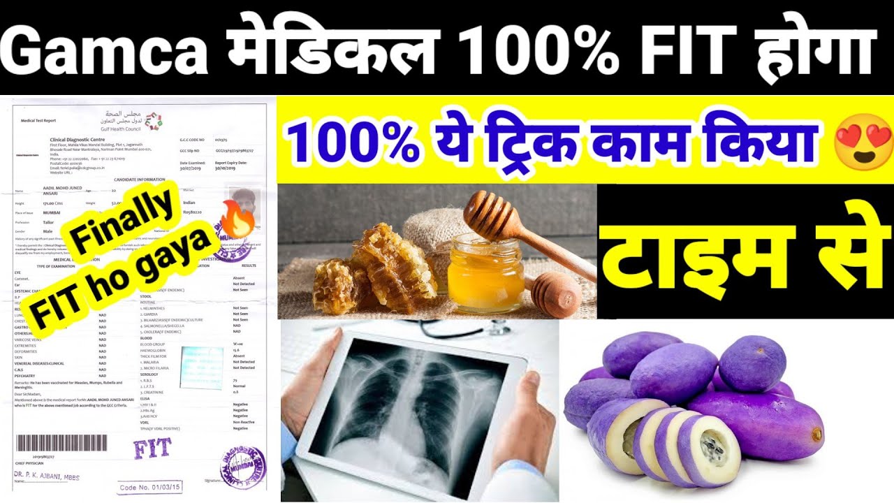 gamca medical kaise pas kare | gamca me x ray fit kaise kare | gamca medical se pahle kya kare