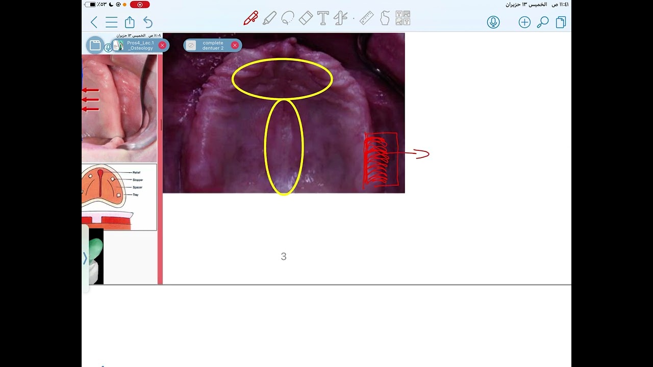 شرح محاضره البروس الثانيه by ream al musawi part 1