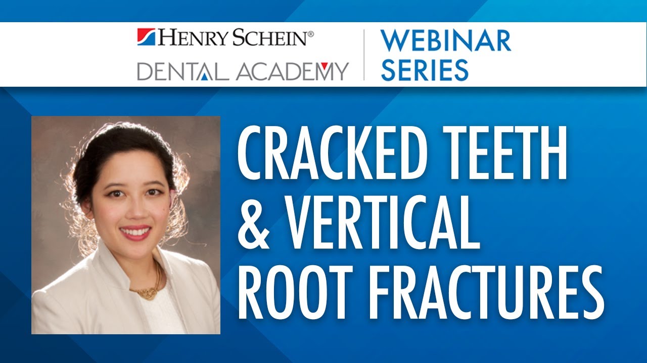 Demystified: Cracked Teeth & Vertical Root Fractures [Diagnosis & Treatment Planning]