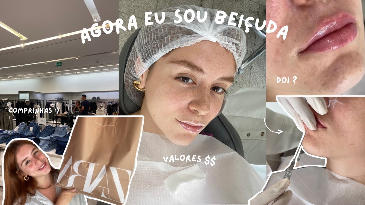 COLOQUEI preenchimento LABIAL | dói ? Valores, experiência, comprinhas… VLOG