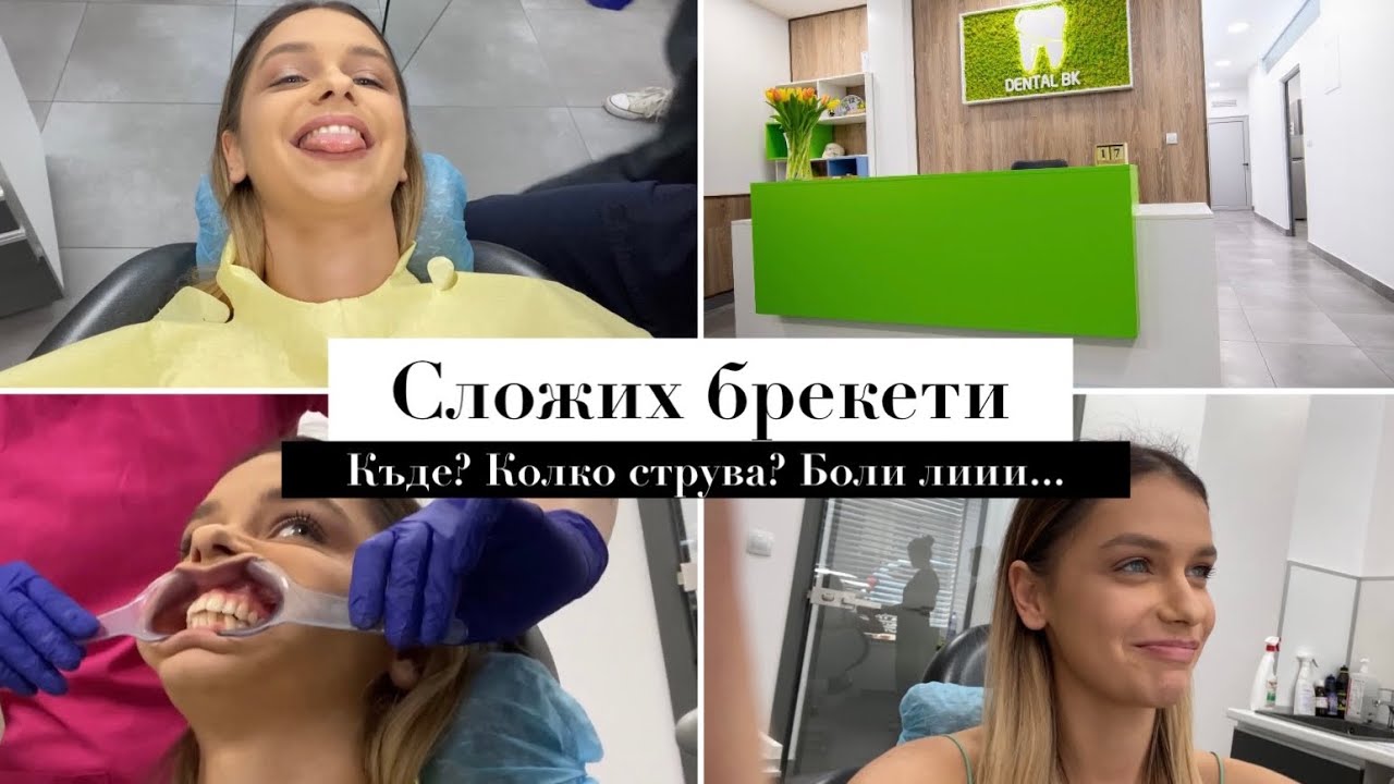 Не мога да повярвам: Най-после сложих брекети!