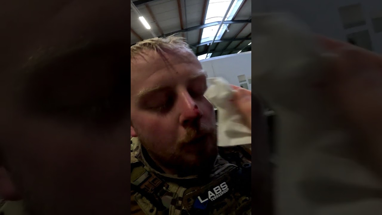 Airsoft INJURY - BB almost stuck in the face