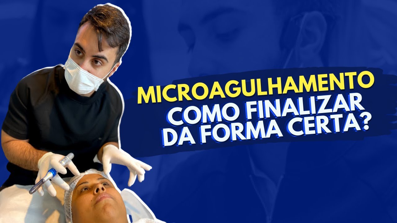Como Finalizar o Microagulhamento da Forma Certa